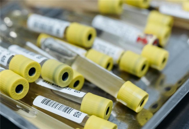 取痰难、检测慢?舌拭子分子检测技术 15 秒无创采样!